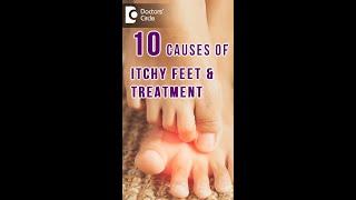 10 Causes of ITCHY FEET & how to get relief? - Dr. Urmila Nischal |Doctors' Circle #shorts