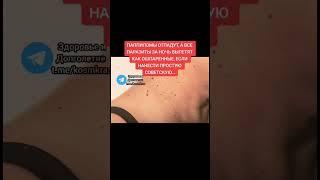 паппиломы отпадут а паразиты ПОВЫЛЕТАЮТ за ночь #народнаямедицина #зож #здоровье #долголетие