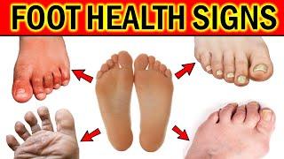 What Your Feet Can Tell You About Your Health