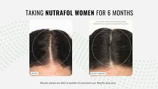 Nutrafol Womens Slide