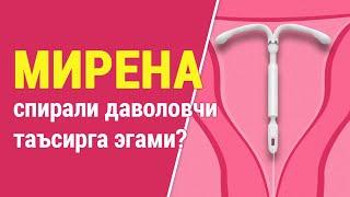 Мирена спирали даволовчи таъсирга эгами?