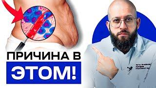 Почему не уходит живот после родов