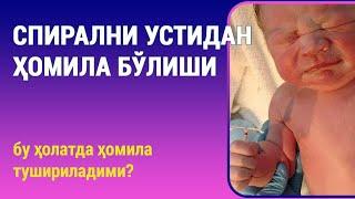 Спирални устидан ҳомила бўлиши: бу ҳолатда ҳомила тушириладими?