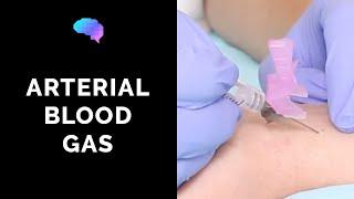 How to take an arterial blood gas (ABG) - OSCE guide | UKMLA | CPSA