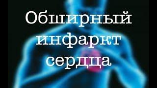 Обширный инфаркт сердца: лечение, прогнозы, причины