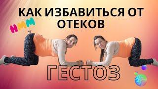 ГЕСТОЗ!!! КАК избавиться от ОТЕКОВ при БЕРЕМЕННОСТИ? Коленно-локтевая поза. Отеки что ДЕЛАТЬ?