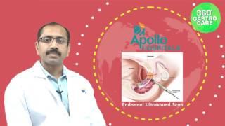 Anal Fistula: Symptoms & Treatment- Apollo Health City