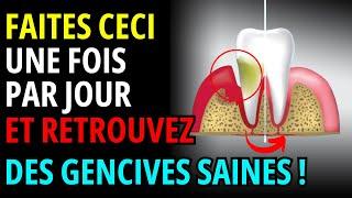 3 habitudes miraculeuses pour assainir et restaurer vos gencives | gencive douloureuse qui saigne