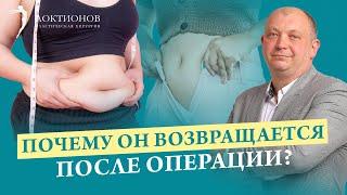 Что делать, если после абдоминопластики опять появился живот? Как сделать плоский живот?