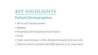 SHOCKWAVE Intravascular Lithography by Dr Suman Bhandari, Fortis Escorts, Noida