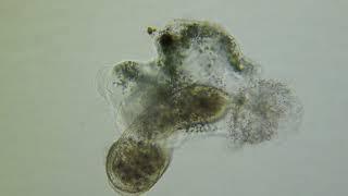 Phagocytosis