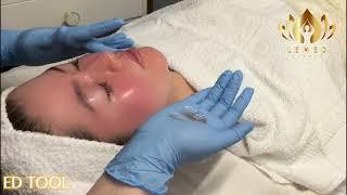 Facial Treatment [ LeMed Clinic]