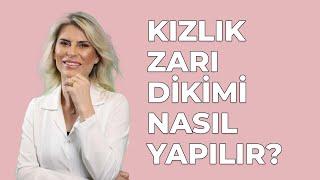 Kızlık Zarı Dikimi Nasıl Yapılır ? - Jin.Op.Dr. Burcu Kardaş Arslan