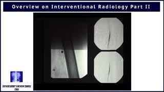 Overview on Interventional Radiology - Part II