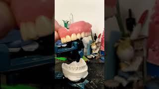 HARZLABS Dental Crown LT В полном съёмном протезе