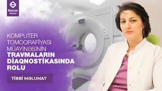 KOMPUTER TOMOQRAFİYASI MÜAYİNƏSİNİN TRAVMALARIN DİAQNOSTİKASINDA ROLU