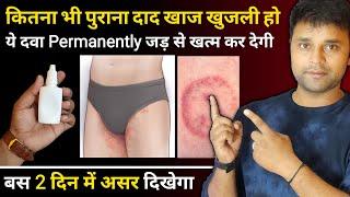 Complete treatment of Fungal Infection | दाद खाज खुजली की सबसे अच्छी दवा