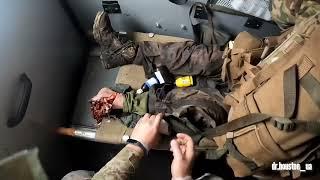 Робота військових медиків на фронті України/The work of military medics on the front of Ukraine.16+