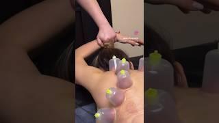 Реабилитационный МАССАЖ  #2024 #massage #массаж #киев #реабилитация #козаков #массажспины