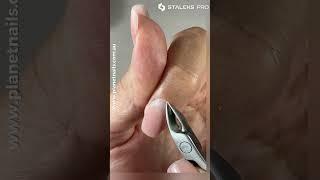 Staleks Pro Nipper