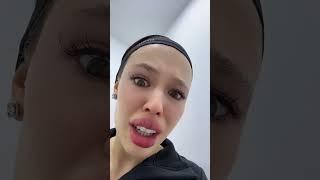 Инстасамка показала губы без филеров  #тикток #tiktok #звезды #цуефа #инстасамка #instasamka