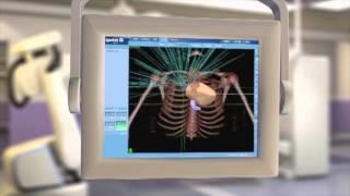 CyberKnife® Radiation Therapy: What It Is & How It Works
