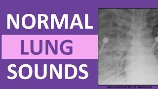 Lung Sounds (Normal) Bronchial Bronchovesicular Vesicular | Breath Respiratory Sounds