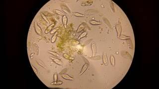 Жизнь под микроскопом: инфузории-туфельки бьются за еду (Life under microscope: Paramecium)