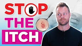 Soothe Eczema Naturally