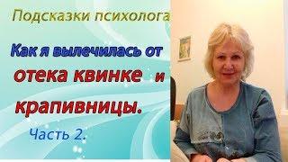 Отек квинке, крапивница. Как я вылечилась от этих болезней. Часть 2