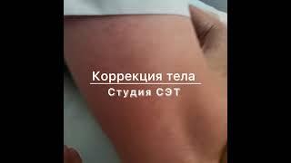 Антицеллюлитный массаж. Коррекция фигуры.