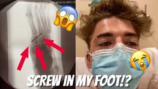 I GOT A SCREW IN MY FOOT! | Joey Klaasen