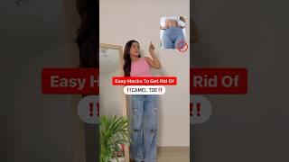 How To Get Rid Of Camel Toe? #fashionhacks #stylehack #fashionguide #styleguide #fashiontips #foryou