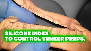 Silicone index to control veneer preps. Силиконовый ключ.