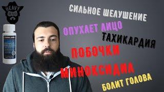 Какие побочные действия от миноксидила?