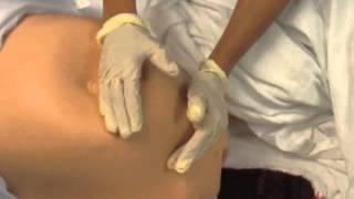 Uterine Massage Technique