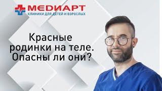 Красные родинки на теле. Опасны ли они? Как обследовать? Как можно удалить?