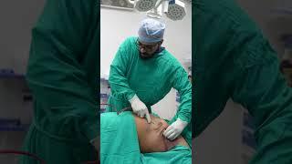 Gynecomastia Surgery | Gynecomastia Surgery cost | #shortvideo #shots