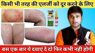 Best medicines for allergy treatment | Treatment of Urticaria | हर तरह की एलर्जी की दवा | inj dexona