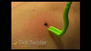 Tick Twister Video