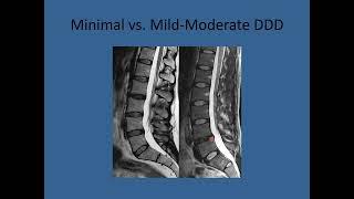 How to read an MRI | MRI image Interpretation