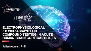 Electrophysiological ex vivo assays for compound testing in acute human brain cortical slices