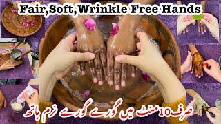 Remove Wrinkles From Hands| Make Your Hands Look 10 Years Younger|Get Baby Soft Hands|Dry Hands