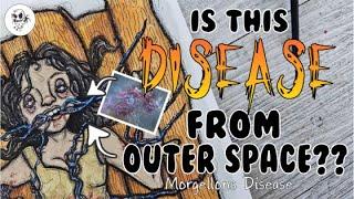 The CONSPIRACY Behind MORGELLONS Disease || Girl Infested ILLUSTRATION