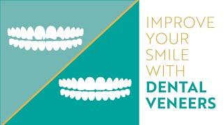 Designing Your Custom Smile with Dental Veneers