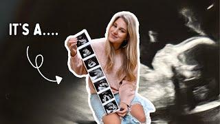 Baby Anatomy Scan + Birthday Surprise