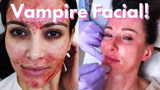 Aqua Gold Facial! DAY IN THE LIFE of a derm Resident! | Dr. Bartos Dermatology