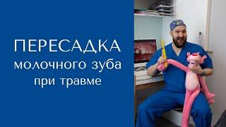 Пересадка молочного зуба на место травмированного постоянного. Стоматология в Красноярске.