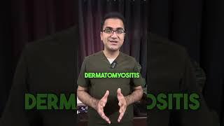 Prodoc Tip 47 Dermatomyositis and Importance of Malignancy Screening USMLE NEETPG