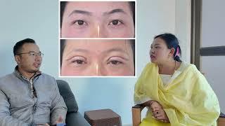 First time eyelid surgery experience shared